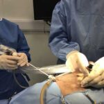 Alasdair Hotston Moore acting as assistant to the learning laparoscopist