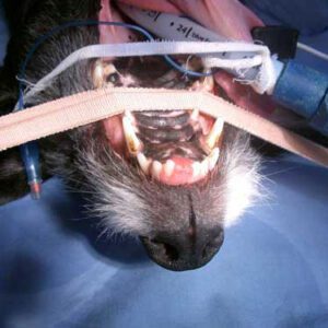 Tumour of the upper jaw ready for surgical removal (premaxillectomy)